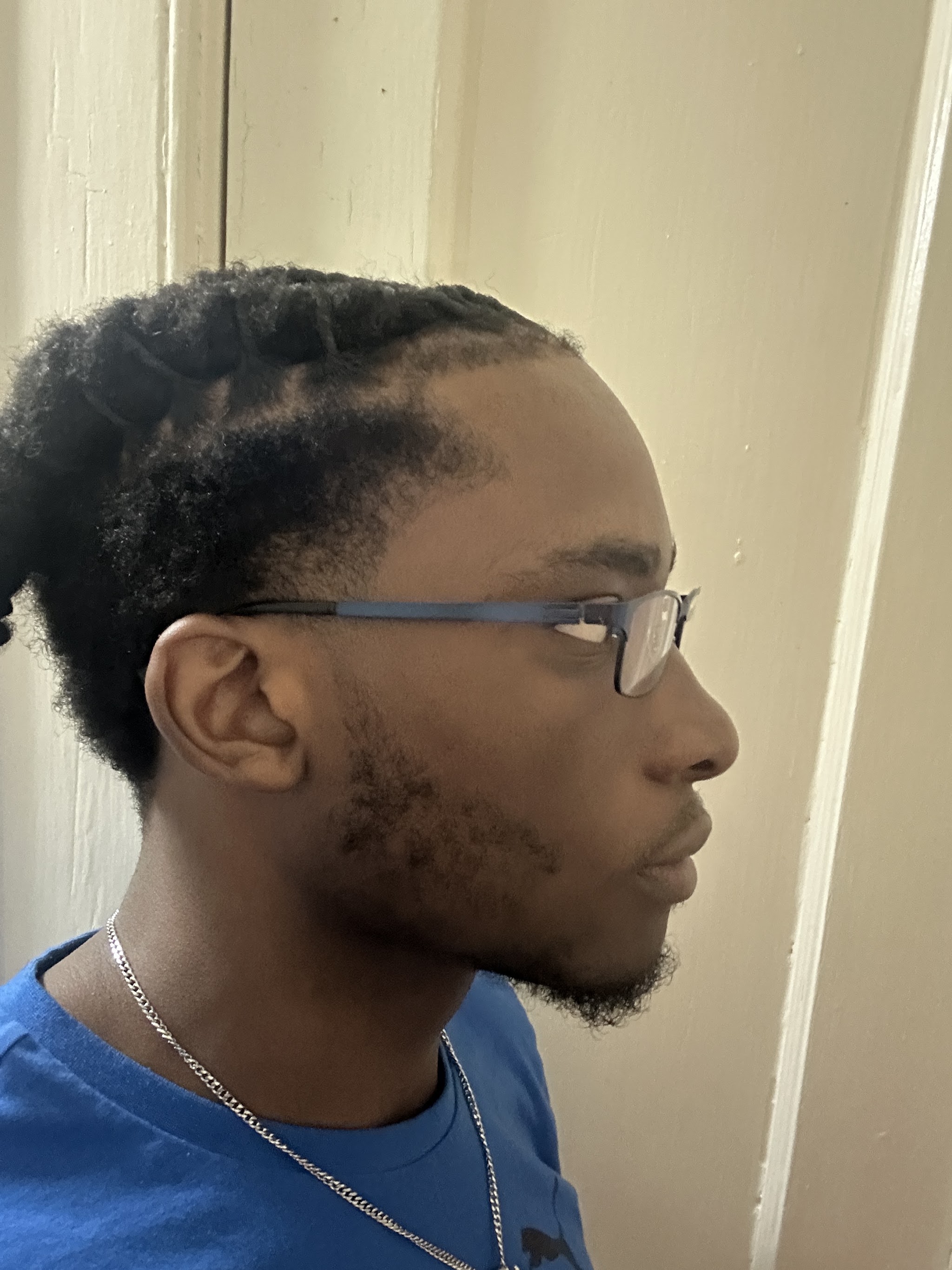 Clean taper fade with twisted top, seen from the side